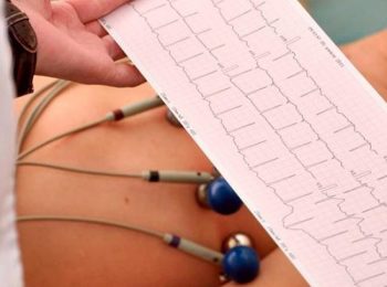 exames_ecg